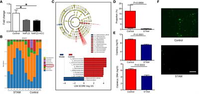 Akkermansia muciniphila suppressing nonalcoholic steatohepatitis associated tumorigenesis through CXCR6+ natural killer T cells